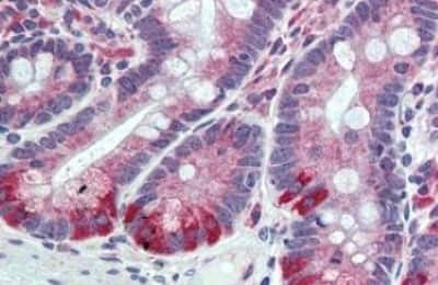 Immunohistochemistry-Paraffin: FAM62A Antibody [NBP3-14561] - FAM62A / FAM62A antibody IHC of human small intestine. Immunohistochemistry of formalin-fixed, paraffin-embedded tissue after heat-induced antigen retrieval.